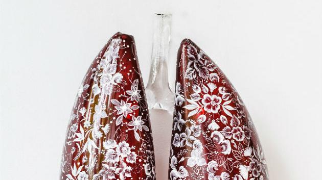 Czech Lungs byly k vidění i na Břevnově. (foto: Aleksi Tikkala)