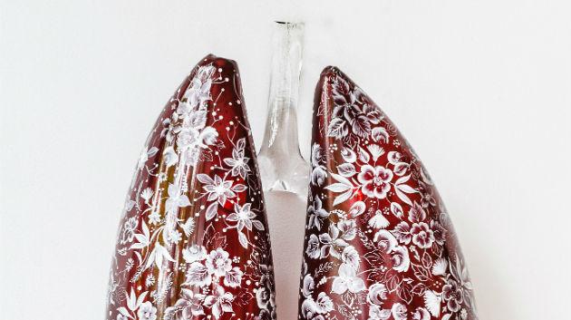 Czech Lungs (photo: Aleksi Tikkala)
